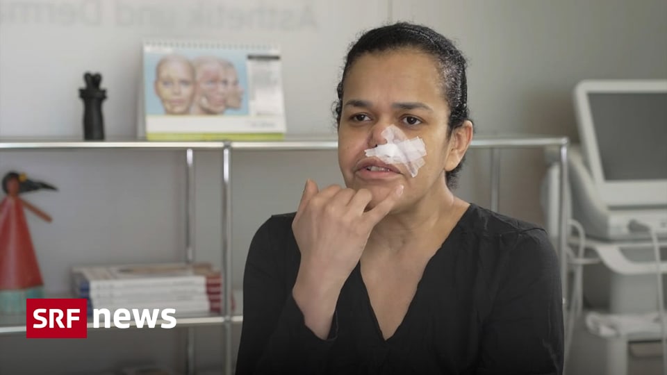 The Hidden Dangers of Illegal Hyaluronic Acid Injections