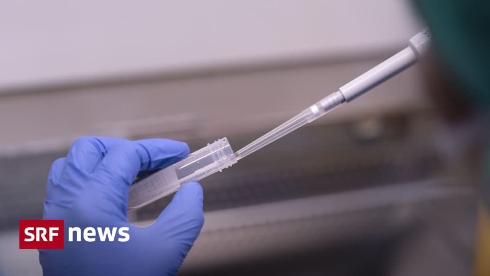 SpitalRechnung «Saumässig» hohe Laborkosten nach CoronaTest News